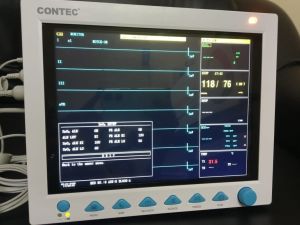 Multi Parameter Patient Monitor with EtCo2 Contec Comen 8000E