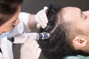 Hair Loss Treatment