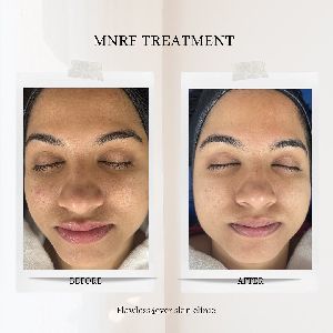 Skin Clinic in Kharadi