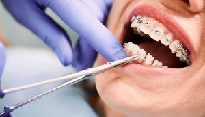 orthodontics treatment service