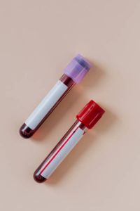 Vaccum Plastic Glass Blood Collection Tube, Brand Name : Peace