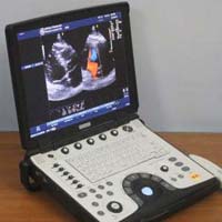 GE Voluson Portable Ultrasound Machine (VIVID E)
