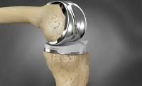 knee prostheses
