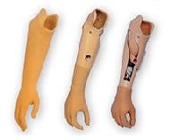 Upper Extremity Prosthesis