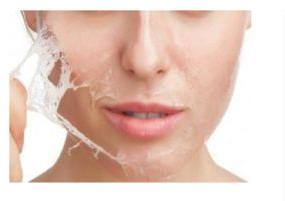 Chemical Peeling Services