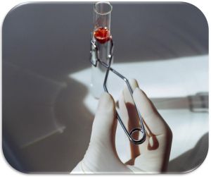 Vinyl Medical Gloves