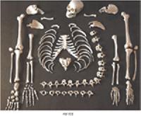 Disarticulated Human Skeleton