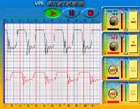 Biomedical Devices