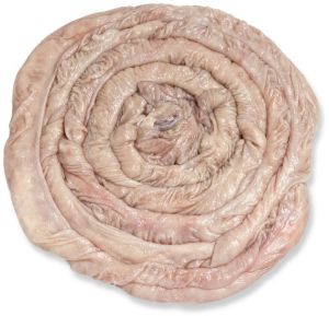 Large Intestine Montalva