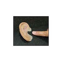 Ear Prosthesis Fitting