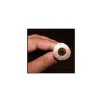 Scleral Shell Prosthesis Fitting
