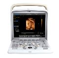 Portable Color Doppler Obstetrics Ultrasound Scanner