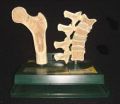 Osteoporosis Models