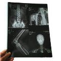 VMS /Poiya inkjet x ray film