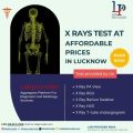 X Ray Test in Lucknow