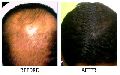 Hair Loss Clinic