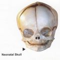 Neonatal Skull