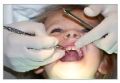 dental disease treatment services