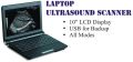 Laptop Ultrasound Scanner